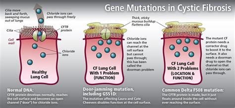 What Causes Cystic Fibrosis Mutation